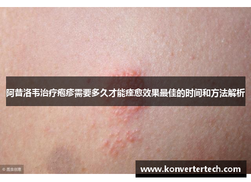 阿昔洛韦治疗疱疹需要多久才能痊愈效果最佳的时间和方法解析