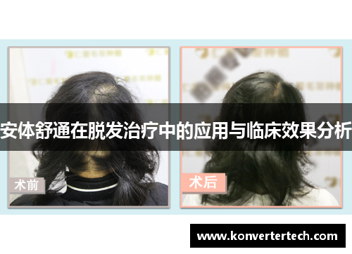 安体舒通在脱发治疗中的应用与临床效果分析