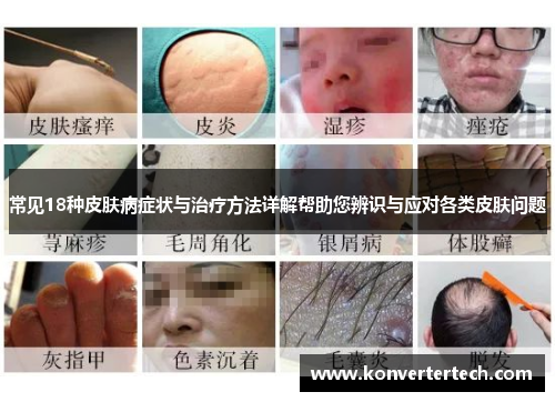 常见18种皮肤病症状与治疗方法详解帮助您辨识与应对各类皮肤问题